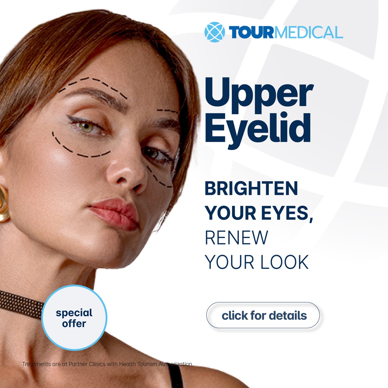 Upper Eyelid Offer img