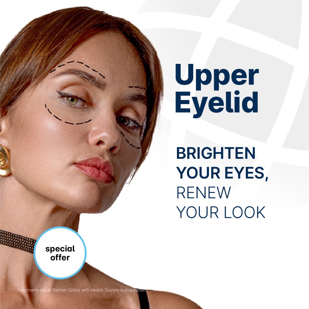 Upper Eyelid Offer
