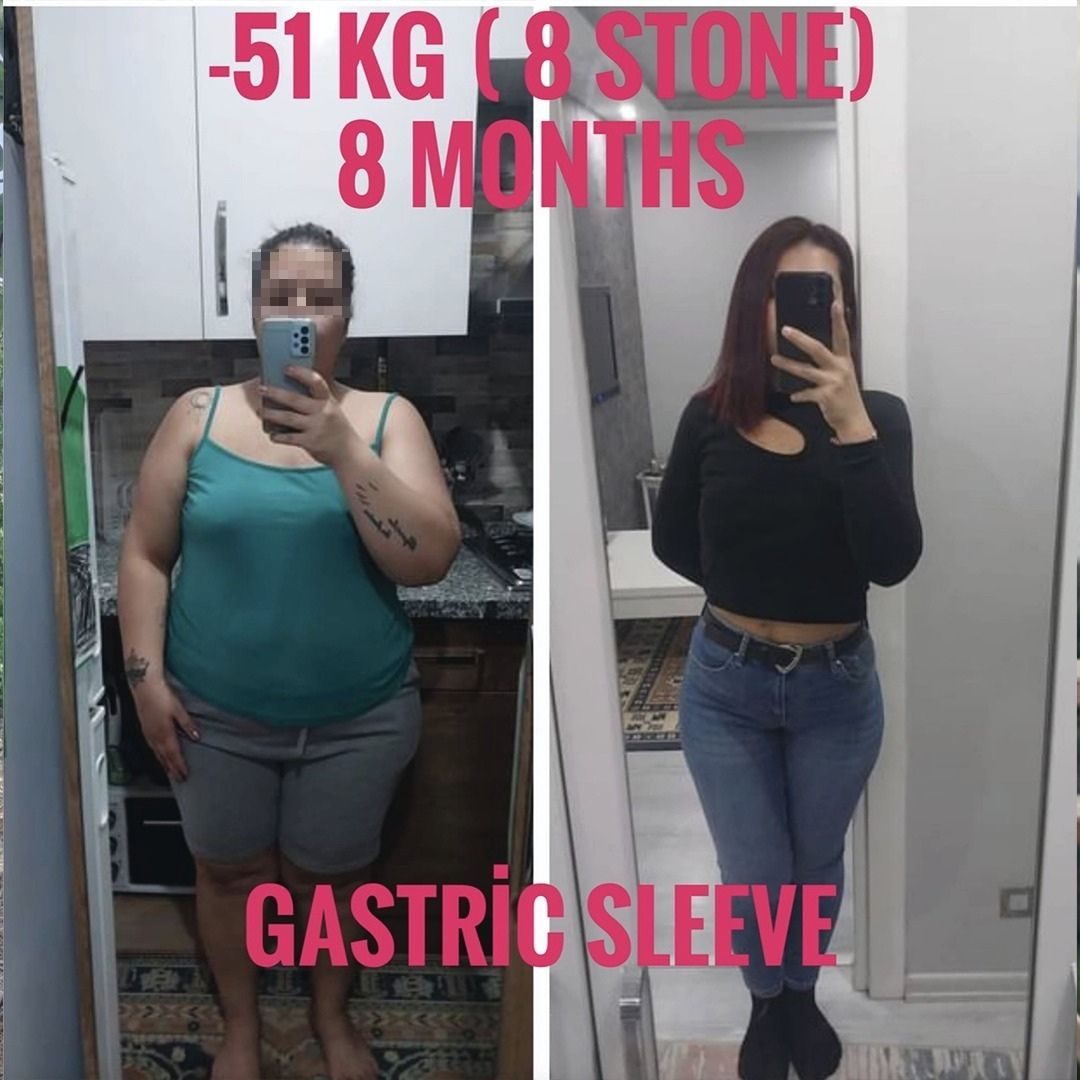 Before & After 1