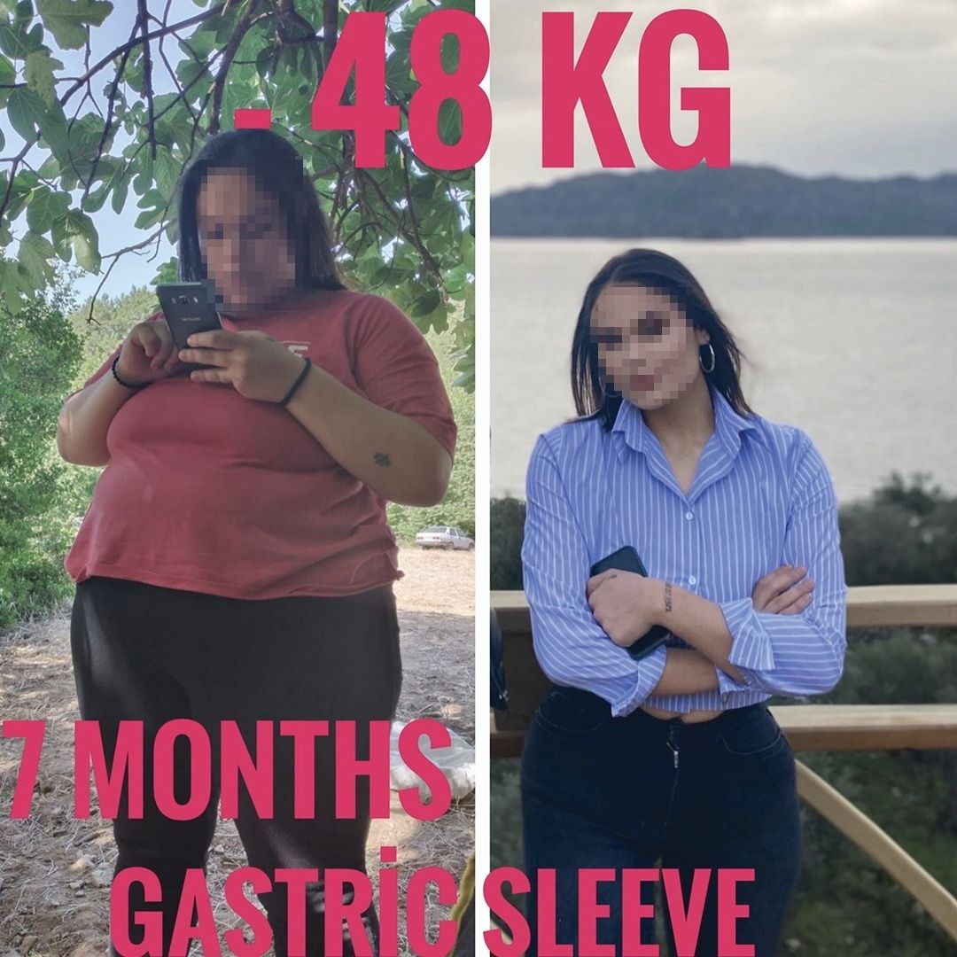 Before & After 2