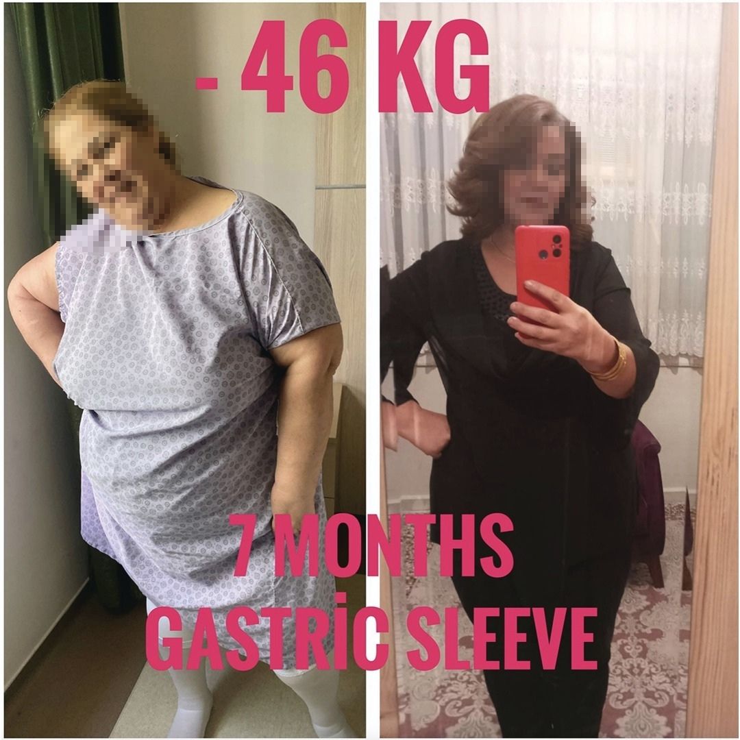 Before & After 3