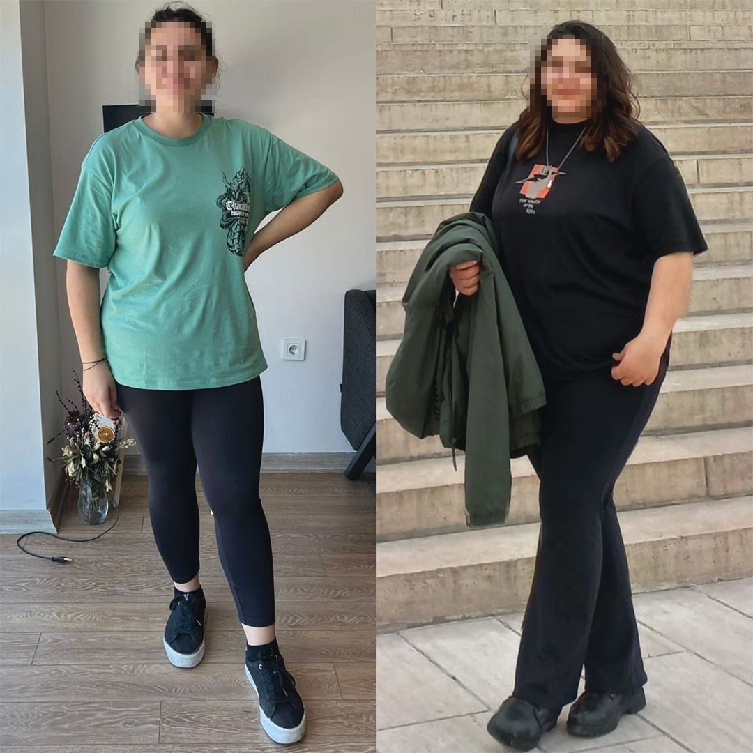 Before & After 4
