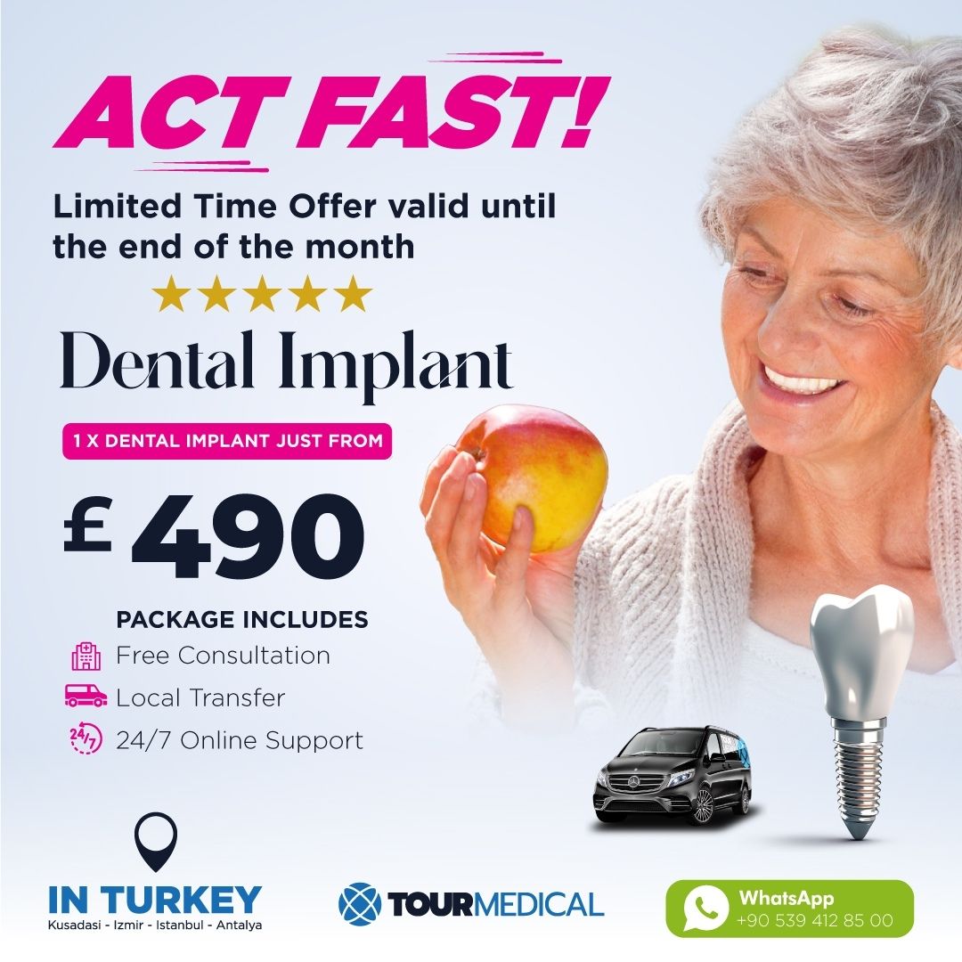 Dental Implants Offer img